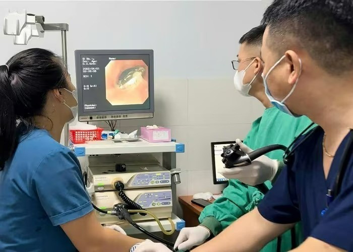 Các y, bác sĩ đang can thiệp trường hợp bé Lý Đ.Đ bị hóc dị vật. 1jpg.jpg