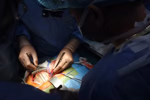 Theo thống kê, chi phí giao động từ 300 – 500 triệu đồng/ca (đã trừ BHYT). Ảnh: BVCC