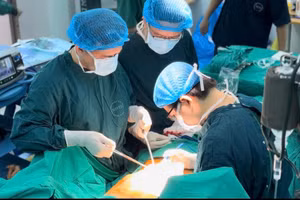 Các bác sĩ phẫu thuật cắt hoàn toàn gan phải cho bệnh nhân. Ảnh: BVCC 