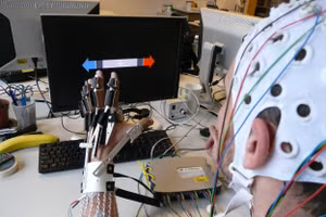 Công nghệ giao diện não - máy tính hỗ trợ người bị bại liệt.