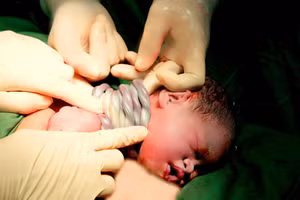 Bé gái nặng 2,5kg chào đời khỏe mạnh, khóc to. Ảnh: BVCC 