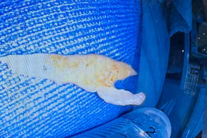 Dị vật là một đoạn xương gà kích thước khoảng 5cm. Ảnh: TTYT Tiên Yên