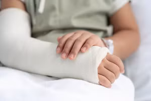 Tai nạn khi vui chơi là một trong những nguyên nhân phổ biến gây gãy xương ở trẻ em. Ảnh minh họa: INT.