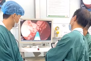 Bệnh nhân được chỉ định nội soi tiêu hóa thăm dò chức năng để tìm điểm xuất huyết. Ảnh: BVCC