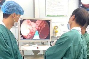 Bệnh nhân được chỉ định nội soi tiêu hóa thăm dò chức năng để tìm điểm xuất huyết. Ảnh: BVCC