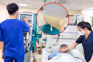 Bệnh nhân bị viêm tụy cấp do tăng Triglycerid (tăng mỡ máu). Ảnh: INT