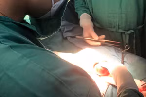 Các bác sĩ phẫu thuật cắt bỏ tinh hoàn cho bệnh nhân. Ảnh: BVCC