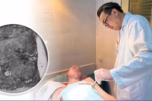 Bác sĩ Thái Văn Bình điều trị cho bệnh nhi. Ảnh: BVCC