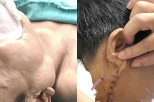 Hình ảnh bệnh nhân trước và sau phẫu thuật. Ảnh: BVCC