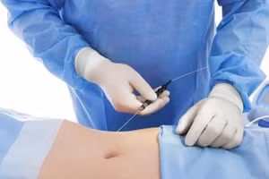 Đừng vì vẻ đẹp bên ngoài mà đánh cược mạng sống bằng tờ giấy cam kết khi bản thân có bệnh nền. Ảnh minh họa: INT