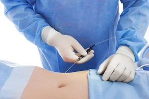 Đừng vì vẻ đẹp bên ngoài mà đánh cược mạng sống bằng tờ giấy cam kết khi bản thân có bệnh nền. Ảnh minh họa: INT