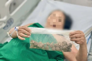 Củ ấu tầu được bệnh nhân mua qua mạng. Ảnh: BVCC