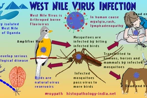 Virus gây sốt Tây sông Nile có thể gây viêm màng não và khiến 32 người Israel thiệt mạng trong vòng 7 tháng đầu năm 2024.