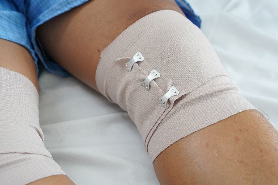 Hiện, bệnh nhân không còn đau và sưng nề ở 2 gối, vết mổ khô. (Ảnh: BVCC) dsc09447.jpg