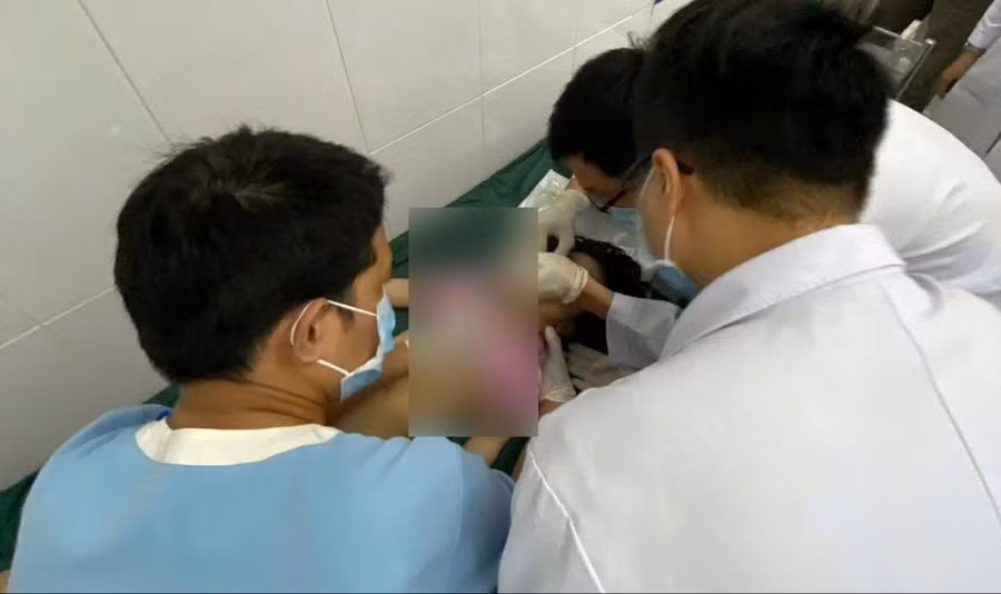 Mặc dù được hồi sức tim phổi tích cực nhưng bé gái không qua khỏi. 