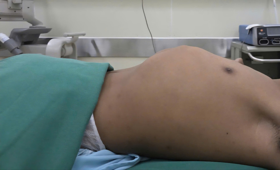 Bệnh nhân trước khi thực hiện phẫu thuật. 