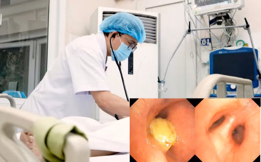 Trẻ nhỏ và người lớn tuổi có nguy cơ hóc dị vật cao. 