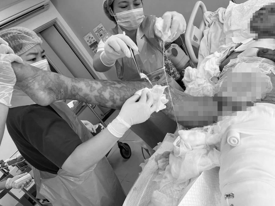 Nguy cơ tử vong của người bệnh đến 50% khi nhập viện.