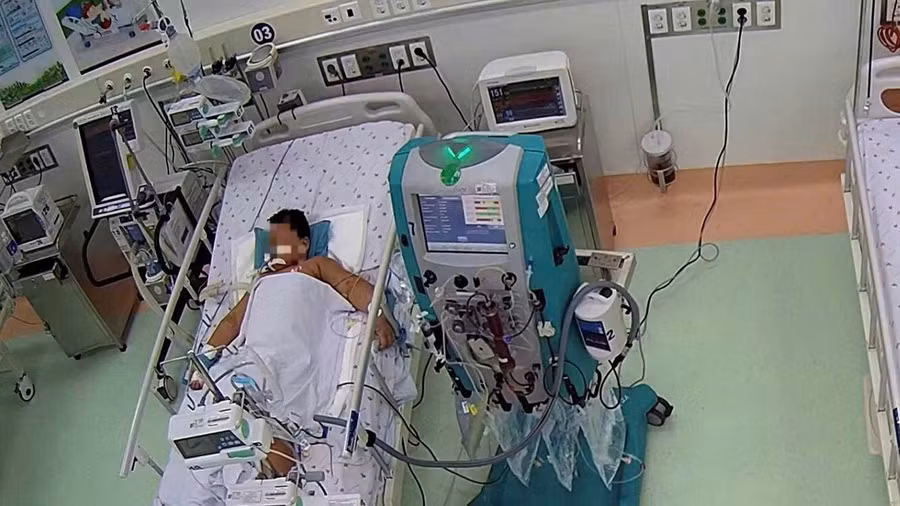 Bệnh nhi trong thời gian điều trị tại khoa Hồi sức tích cực Chống độc - Bệnh viện Nhi đồng 1. (Ảnh: BVCC)