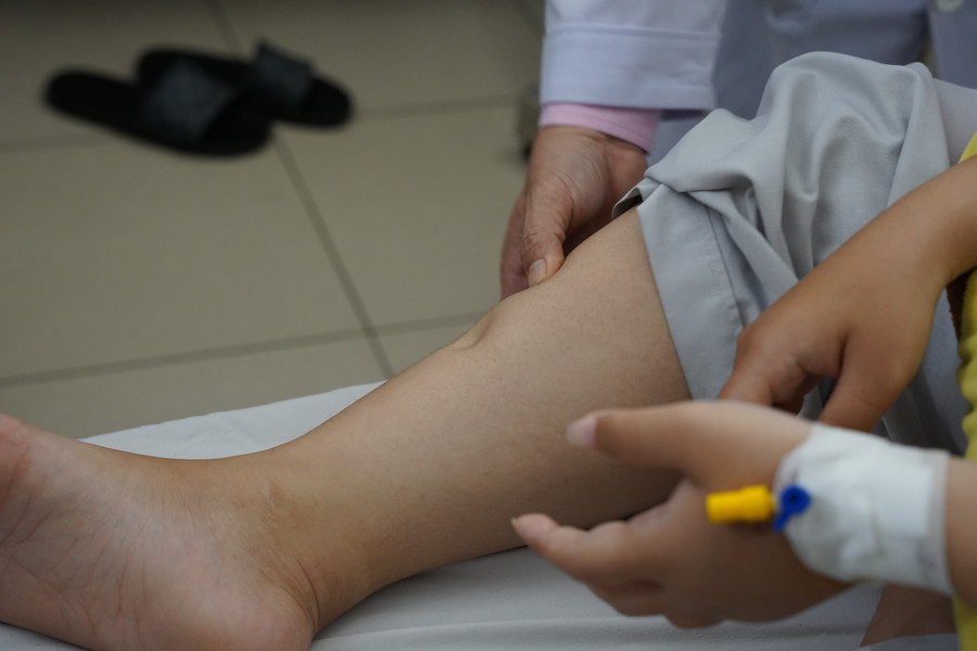 Sưng phù chân tay nhẹ cũng có thể là dấu hiệu âm thầm của người mắc bệnh thận. dsc00007.jpg