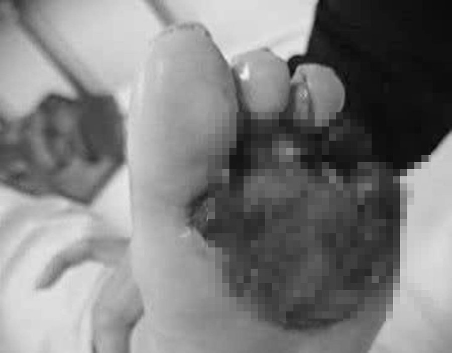 Bệnh nhân đang được các bác sĩ tích cực điều trị. anh-2-1.jpg