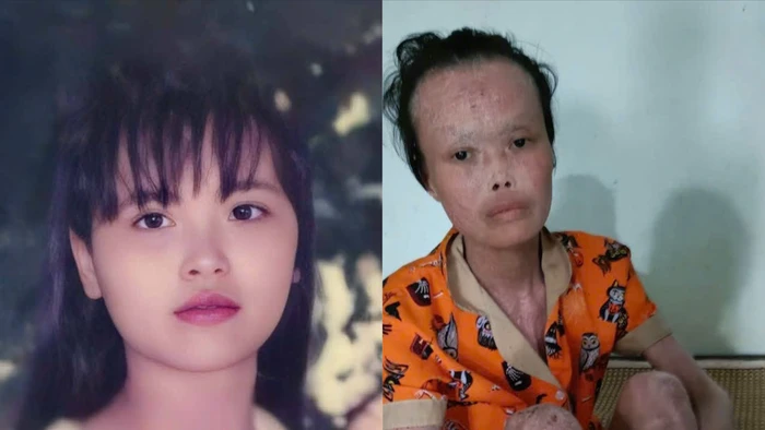 Đẫm nước mắt trước tình cảnh của cô giáo bạc mệnh 