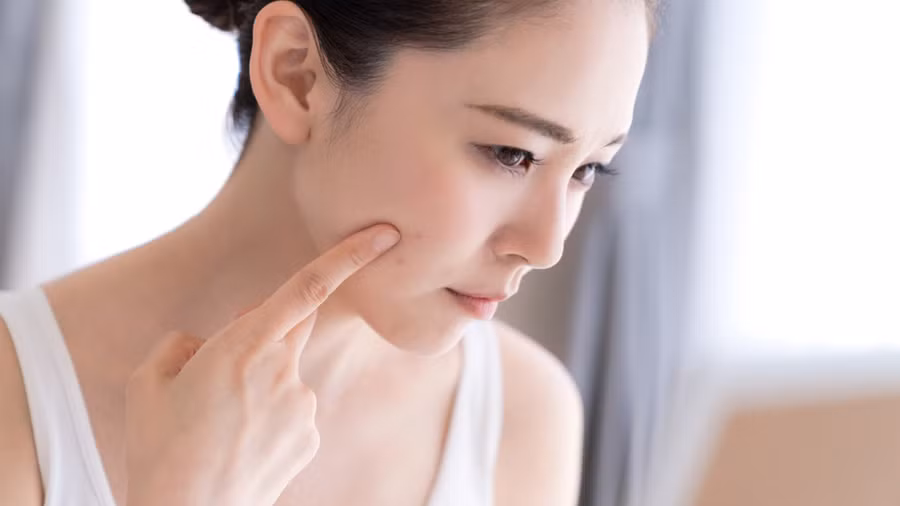 Da khô là sự khởi đầu của quá trình lão hóa. (Ảnh: ITN)