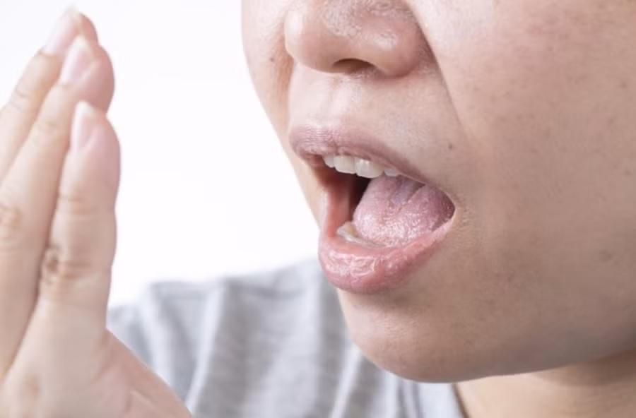 Hôi miệng, niêm mạc miệng nhợt nhạt cũng là tín hiệu cảnh báo về thận. (Ảnh: ITN)