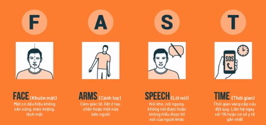 Nhồi máu não: Nguyên nhân, dấu hiệu cảnh báo sớm và cách phòng ngừa hiệu quả ảnh 2 Nhồi máu não: Nguyên nhân, dấu hiệu cảnh báo sớm và cách phòng ngừa hiệu quả ảnh 2