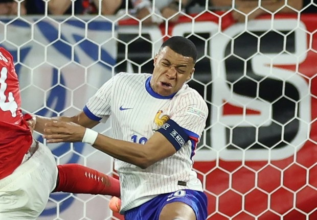 Chùm ảnh: Mbappe gãy xương mũi, phải đeo mặt nạ ở EURO 2024 