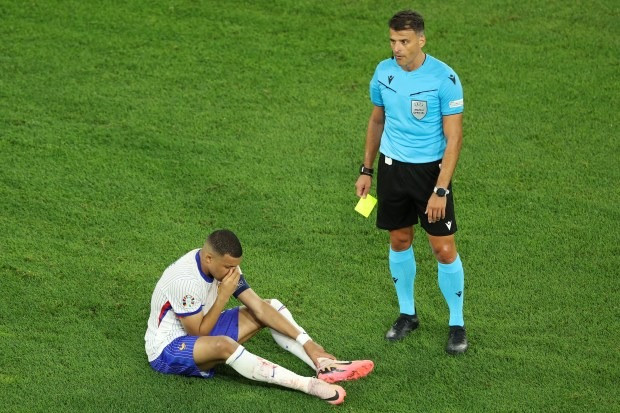 Chùm ảnh: Mbappe gãy xương mũi, phải đeo mặt nạ ở EURO 2024 