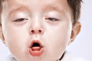 Bệnh ho gà thường xảy ra ở trẻ dưới 5 tuổi. (Ảnh minh họa: ITN).