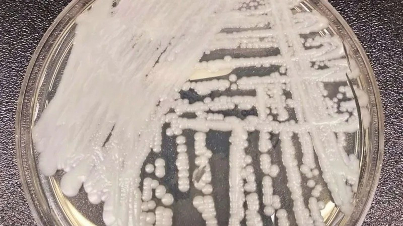 Siêu vi khuẩn lan rộng tại 27 bang Mỹ đây là nơi loại nấm gây chết người đang hoành hành.