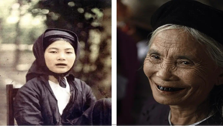 Phụ nữ Việt Nam với hàm răng đen. 