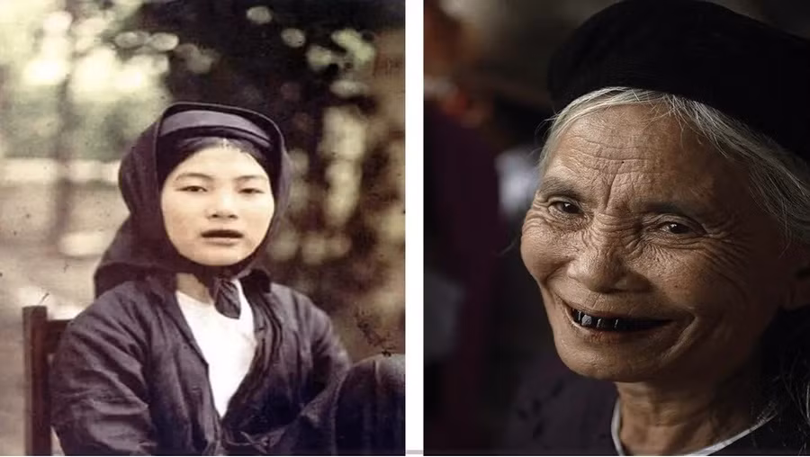 Phụ nữ Việt Nam với hàm răng đen. 