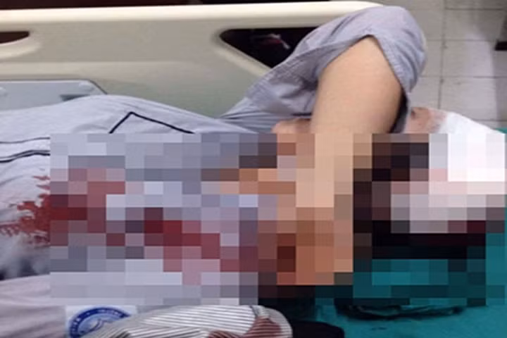 Công an đã triệu tập hai nghi can liên quan đến vụ việc nữ sinh lớp 10 bị hành hung phải nhập viện ở Hà Nội. Ảnh: Công lý