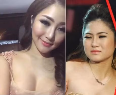 Huong Tram lieu co giong Huong Ho, nghien phau thuat tham my? - Anh 4