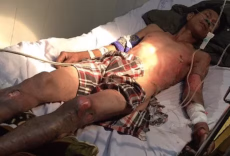 No 30 ngan khong duoc, thanh nien lay xang dot chu quan bi-a - Anh 2