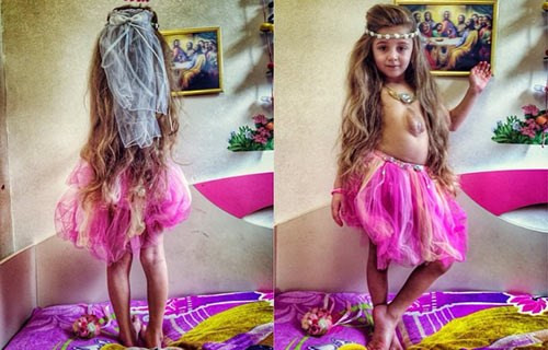 Kỳ lạ bé gái có quả tim 