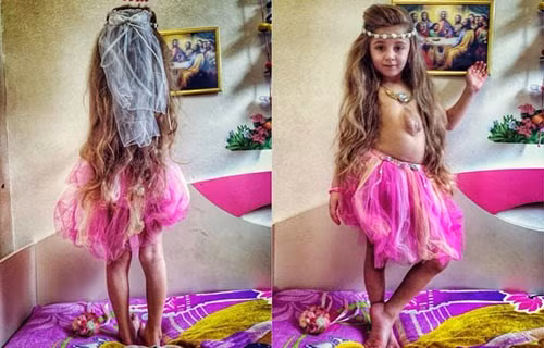 Kỳ lạ bé gái có quả tim 