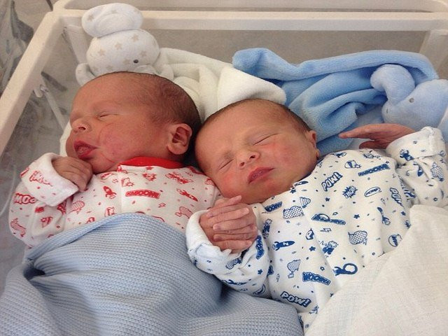 anh: anh em song sinh nam chat tay nhau khi vua ra doi hinh anh 1