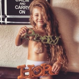 Kỳ lạ bé gái có quả tim 