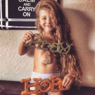 Kỳ lạ bé gái có quả tim 