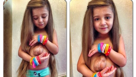 Kỳ lạ bé gái đẹp như thiên thần có trái tim nhô ra ngoài cơ thể ảnh 1