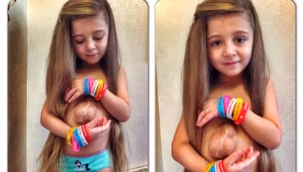 Kỳ lạ bé gái đẹp như thiên thần có trái tim nhô ra ngoài cơ thể ảnh 1