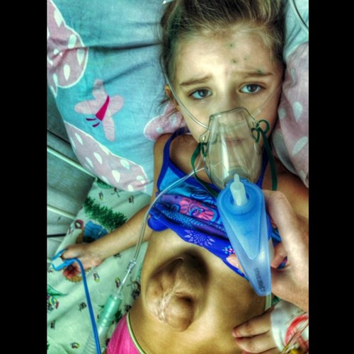 Kỳ lạ bé gái có quả tim 