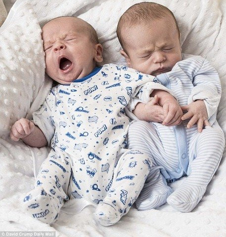 anh: anh em song sinh nam chat tay nhau khi vua ra doi hinh anh 3