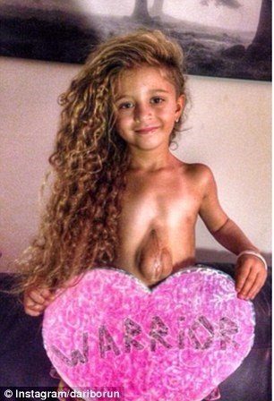 Kỳ lạ bé gái có quả tim 