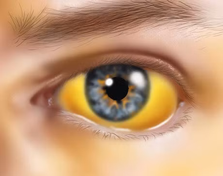 6 dau hieu canh bao gan gap van de - Anh 2