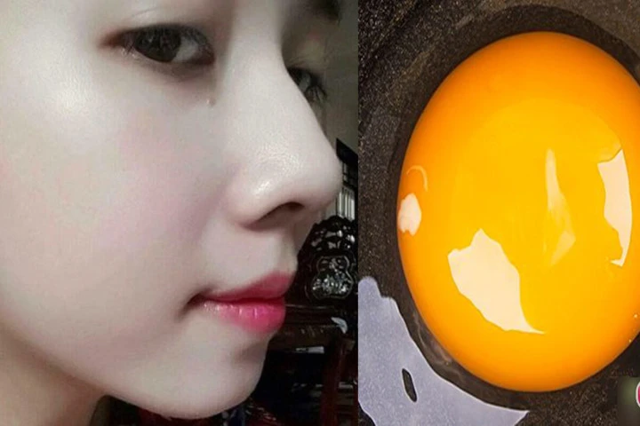 Để có làn da đẹp miễn chê bạn gái không thể bỏ qua 4 loại mặt nạ từ trứng gà